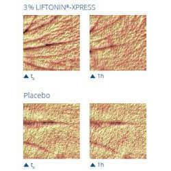 Liftonin Xpress
